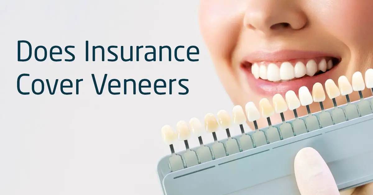 Will My Insurance Cover Veneers