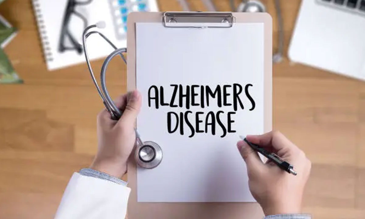 Fisher Scale aids early Alzheimer’s diagnosis